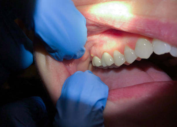 Best Orthodontic Emergency Dentist in Drain, OR