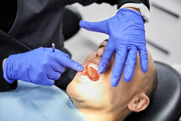 Best Emergency Dentist for Lost Fillings or Crowns in Drain, OR