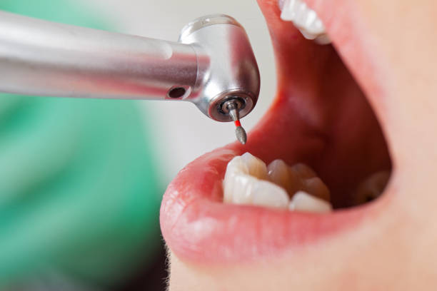 Best Weekend Emergency Dentist in Drain, OR